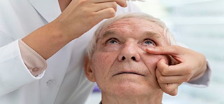 Epidemiologi Katarak Tantangan Kesehatan Mata Global