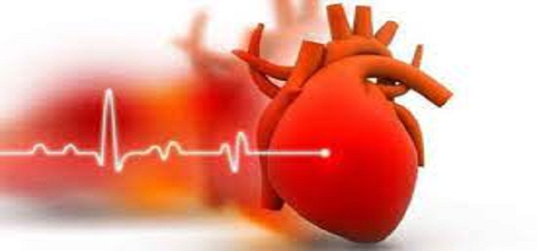 Ringankan Angina Dengan Bahan Alami Berikut ini